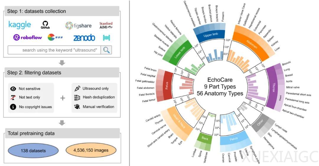 CAIR开源发布超声基座大模型EchoCare“聆音”,10余项医学任务性能登顶
