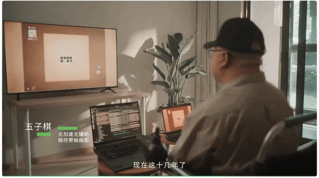 比马斯克Neuralink工艺更先进!我国成功开展首例侵入式脑机接口临床试验