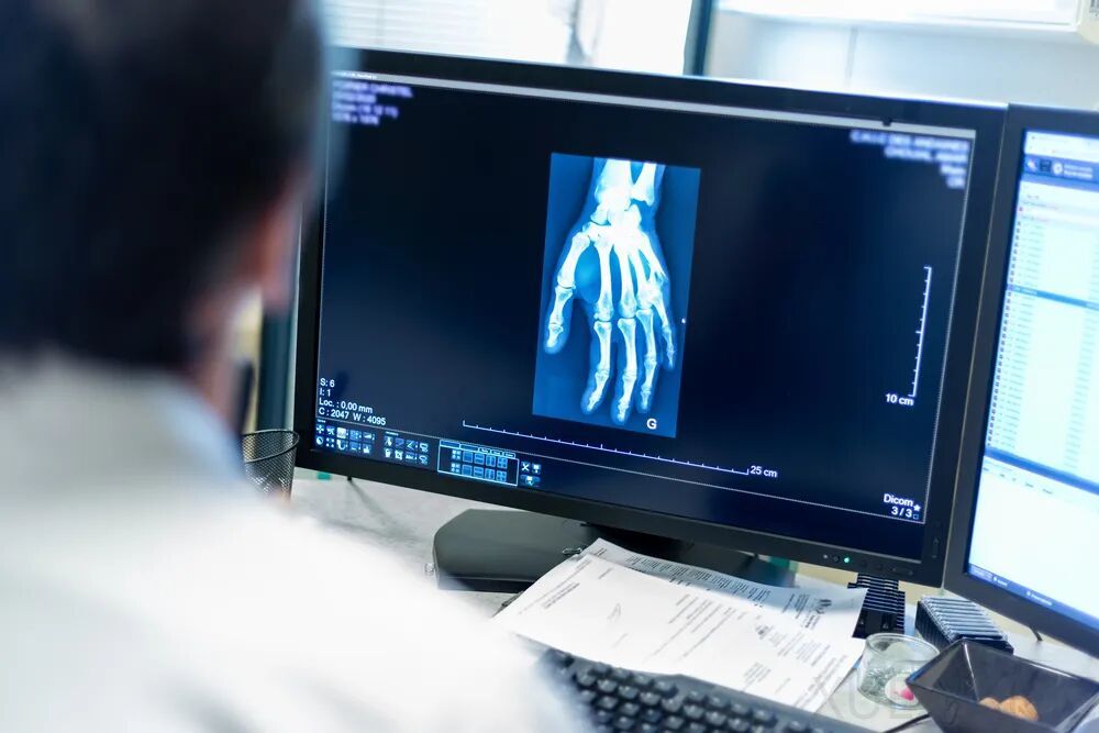 上市首日大涨111%！智谱MiniMax之后，德适交出大模型商业化最硬核答卷